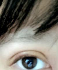 成都双眼皮医生刘晶,双眼皮最全攻略都在这!