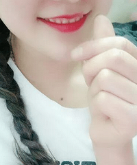 在成都做隐形牙齿矫正,预算多少才够?隐适美和时代天使的区别?