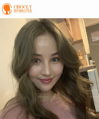 成都隆鼻手术,做隆鼻,选择玻尿酸隆鼻还是假体隆鼻?