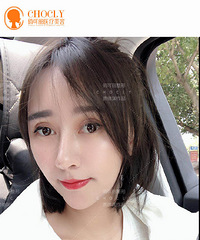 成都隆鼻手术,做隆鼻,选择玻尿酸隆鼻还是假体隆鼻?