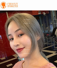 成都肋软骨隆鼻医生,贾德渊做肋软骨隆鼻好不好