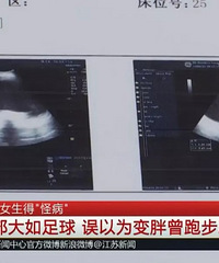 大一女生肚子大得像8个月孕妇,每天跑步也减不掉!最后竟查出是..