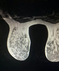 20��ͷ�Ĺ��ﱻ������ĥ���ˣ�ҽ��˵���������ﲻ�ټ���