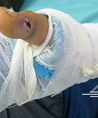 �߾���Ů�ӱ�ҧ�ˣ��ⶾ���ѱ��߶Ȱ׾����������ˡ�