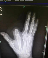 �������ӱ��岽��ҧ��,��һ��ն����ָ!"����,����Ҫ��!"