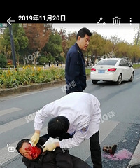 被撞得血肉模糊!骑电动车出行头盔真的太重要了