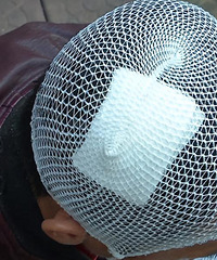 ����������Ƭ������ͷ��Ѫ����ȴ������ˡ�ԭ����������