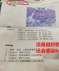 只交往过一个男朋友,怎么就感染了hpv呢?