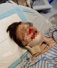 天降横祸!今早一大片玻璃从5楼坠落!大妈被砸血淋淋!