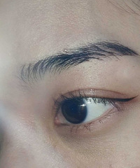 想在遵义做双眼皮手术,求推荐哪家医院比较好