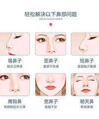 贵阳鼻综合整形(鼻综合整形医院)多少钱1次?