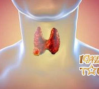 甲状腺虽小,却非常关键!一旦“失衡”,就会引发这些甲状腺疾病