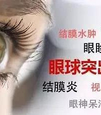 【健康常识科普】甲亢性突眼患者平时应该怎样保护眼睛比较好