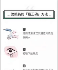 跟姐姐组团摘镜|苏州明基医院太学眼科近视激光手术术后半年纪念
