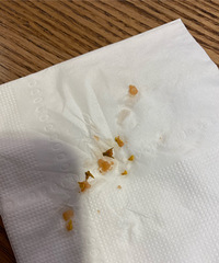 國慶在西湖邊的飯店吃桂花藕,口腔都被劃傷