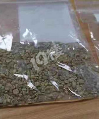 密密麻麻,浙江六旬大妈右肾竟取出1000余颗......