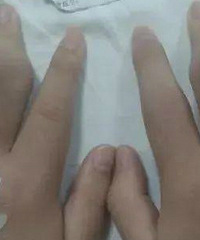 22岁女老师一天一杯奶茶,抽出的血都是乳白色的