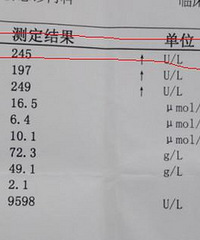 【戒酒日记】医生说我再喝下去,肝功能会丧失