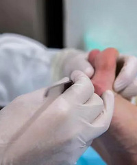 10岁男孩上游泳班,脚底板长出密密麻麻小疙瘩,竟是感染HPV!