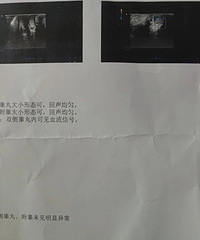 都是一岁半,我家宝宝阴囊怎么比亲戚家孩子的瘪?