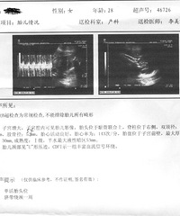 "28周BC数据,和糖筛数据,猜男女(附肚肚照)"