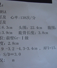 "三维BC回来,发现宝宝的鼻子跟老公一样是洋葱鼻"