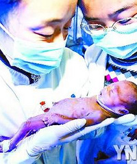 重庆最袖珍婴儿重610克 脑袋仅鹅蛋大