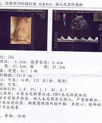 "第二胎宝宝三位B超,公布男女啦~~"