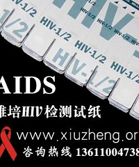 什么是艾滋病
