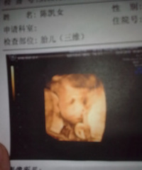 "市二三维B超图,很清晰及如何看孕检及B超相关数据"