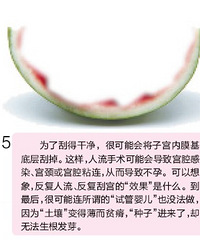 "18岁女孩来做第五次人流 别把“人流”当“流感”"