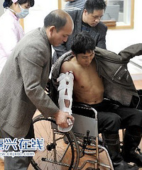 昨晚云南男子手臂受伤严重