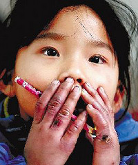 嘉兴一民工子女满手冻疮呵气取暖上课惹心酸(图)