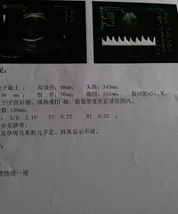 40+4�����ֱ��ϻ����ˣ�˫�����Ѿ�98��