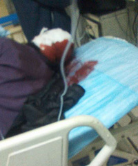 ��������������'��ͷ�����ͷƤ��˺��'�ֲ�