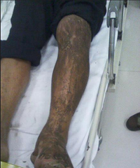 ����һ������ȥС�㱻����ҧ����û����������˯��