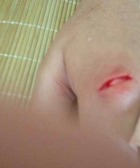 ҽ����ϵ���ţ������к�Ⱥ֮��