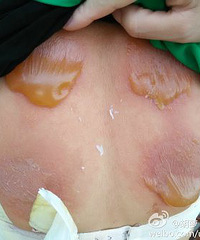 ������ҽԺ���������еĶ������ξ���������ô��