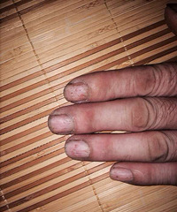 ��������ҽ �ж�����İ�æ���º���