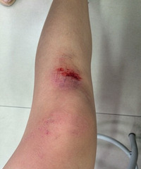 ��ְԺ�����⾮�ǣ���㺦�Ҷ���������