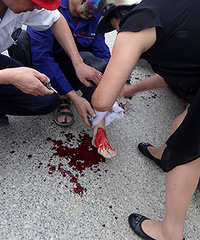 �ﳵײ��Ѫ����ע ���˰���Ʒ�¸���ʩԮ��