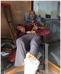 ������������·���˹���Ͷ����������ӹǶ�����