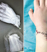 ʹ��5��Ů���ܽ���ľ����ˣ�����������ж�