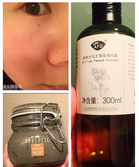 去黑头缩毛孔 我就靠这些