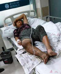 ��ɷ��������ҧ��һ��7Ѯ��̫С���׵������һ����