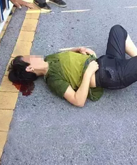 ƽ����һŮ�ӱ�����ײ��֮���Դ�����һ̲Ѫ����