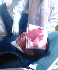 �񳿶���ƿ������ӭ����ײ,�ֳ��Ҳ��̶�