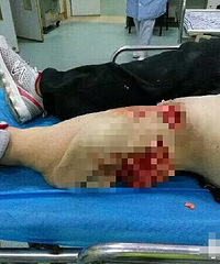 �ң����������ƿ����������Ů֬���������䣬�Ҳ��̶�