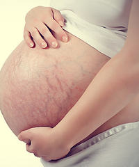 ����� �����Ʒ賤 ����Ԥ���Ķ���