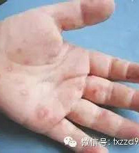 5������ڲ��������ڣ����˱����Ǹ�֪������